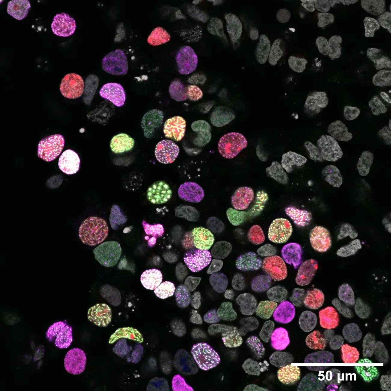 Fluorescence microscopy showing meiosis induction in cells derived from human induced pluripotent stem cells